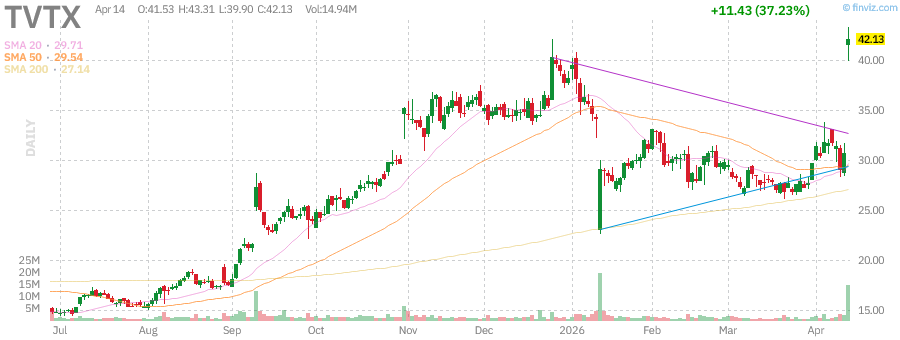 TVTX technical chart with RSI, MACD, Bollinger Bands