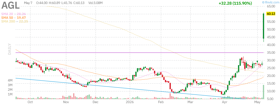 AGL technical chart with RSI, MACD, Bollinger Bands