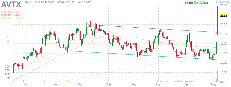AVTX technical chart with RSI, MACD, Bollinger Bands